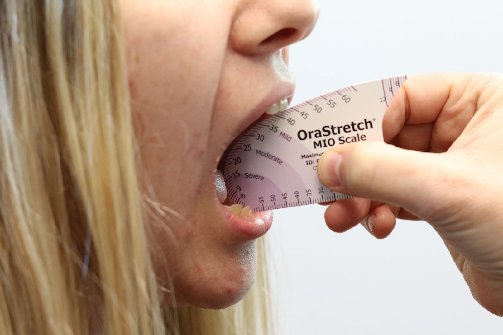 Can Physical Therapy Help TMJ Pain? A Comprehensive Insight The Therapy Network Physical Therapy